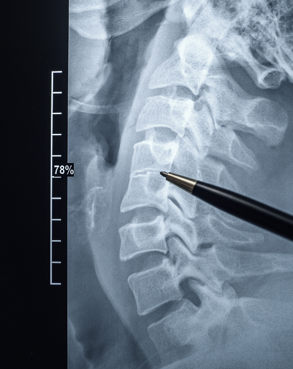 Diagnostic imaging used to locate the source of pain